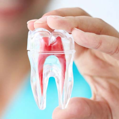 صحة الأسنان وقنوات الجذر