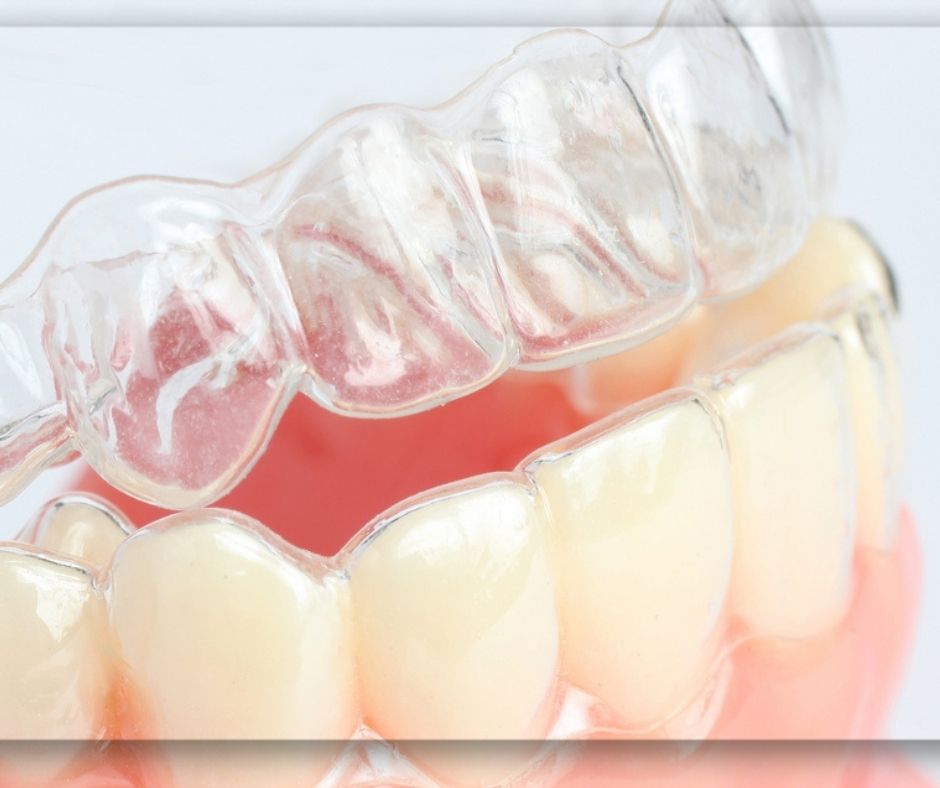 أبرز و أهم 9 علاجات للأسنان في تركيا