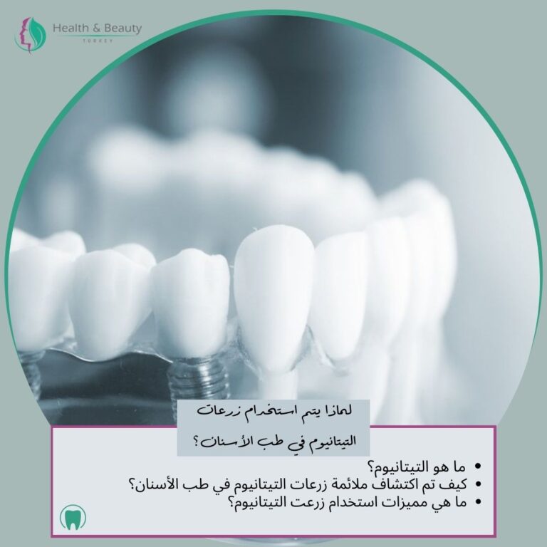 لماذا يتم استخدام زرعات التيتانيوم في طب الأسنان؟