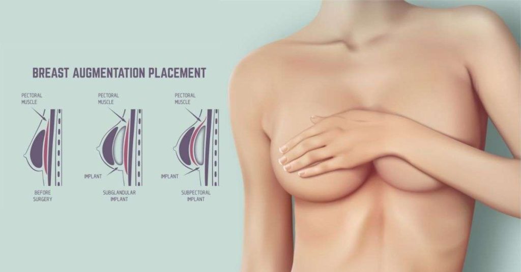 عملية تكبير الثدي بالليزر كيف يتم أجراءها في تركيا