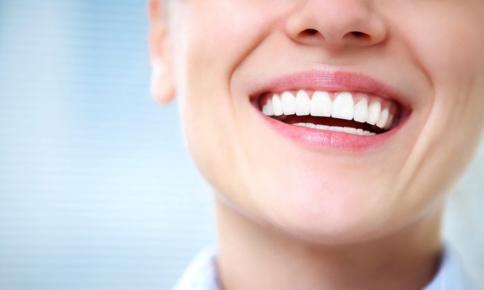 عملية زراعة الأسنان و الأبتسامة الطبيعية