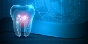 معالجة الأسنان بالليزر علاج بديل وسريع 2022