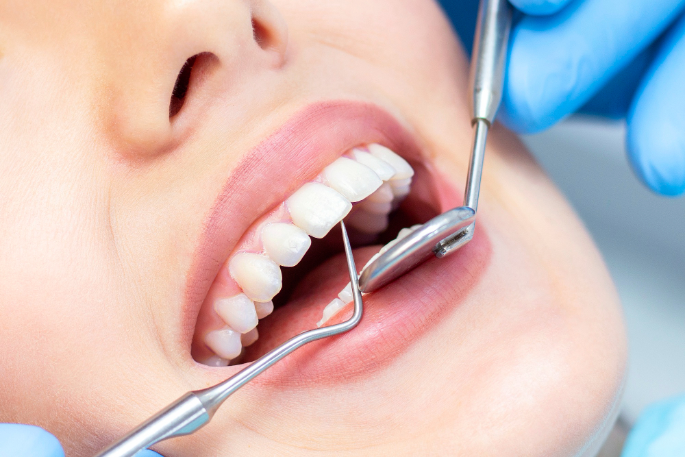 ما هي افضل طرق لتجميل الاسنان؟