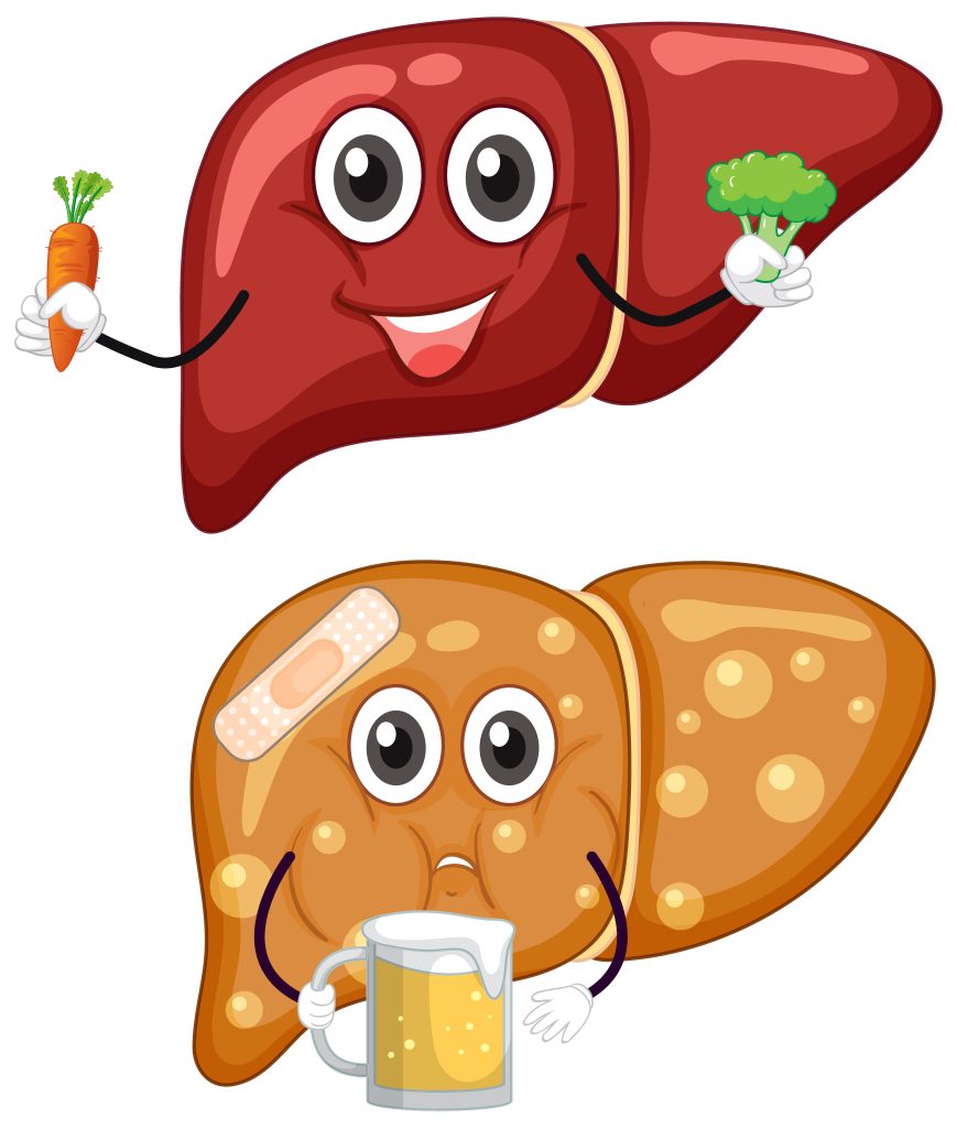 الكبد الدهني | المسببات وكيفية العلاج