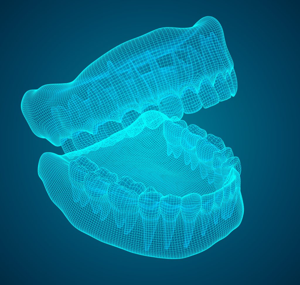 زراعة الأسنان الموجهة (3D)