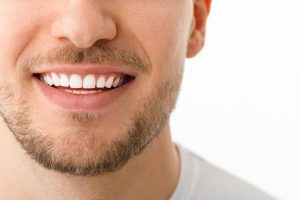 زراعة الأسنان الموجهة (3D)