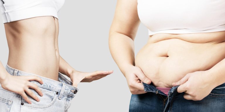 Tummy Tuck Surgery (Abdominoplasty)