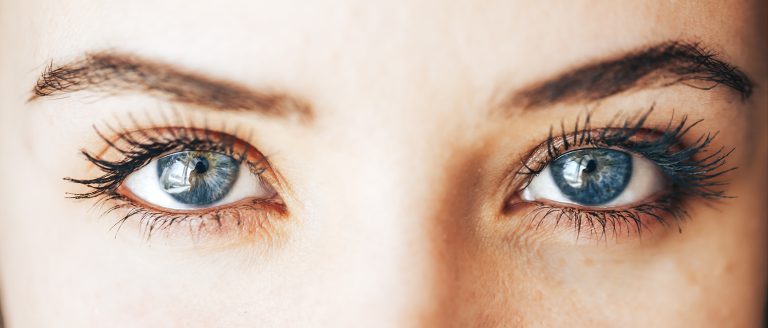 Fox Eye Surgery (Canthoplasty) Fox Eye Surgery (Canthoplasty)