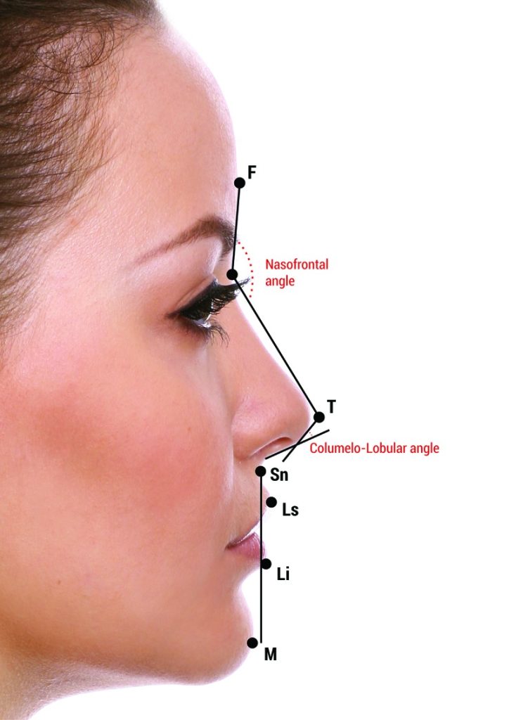 استعلم عن عمليات تجميل الأنف في تركيا