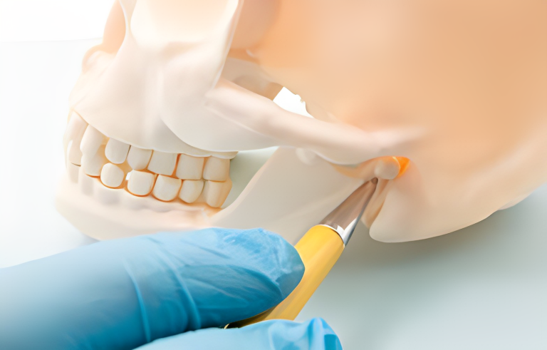 TMJ Surgery TMJ Surgery