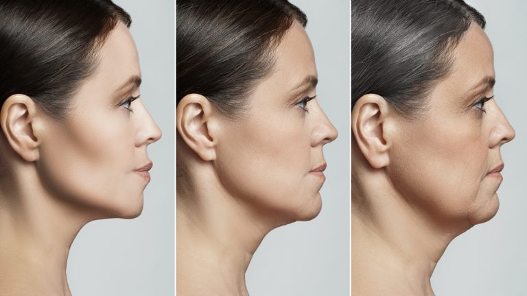 Double Chin Surgery? Don't Panic: A Guide to Exploring Surgical and Non-Surgical Solutions Double Chin Surgery? Don't Panic: A Guide to Exploring Surgical and Non-Surgical Solutions